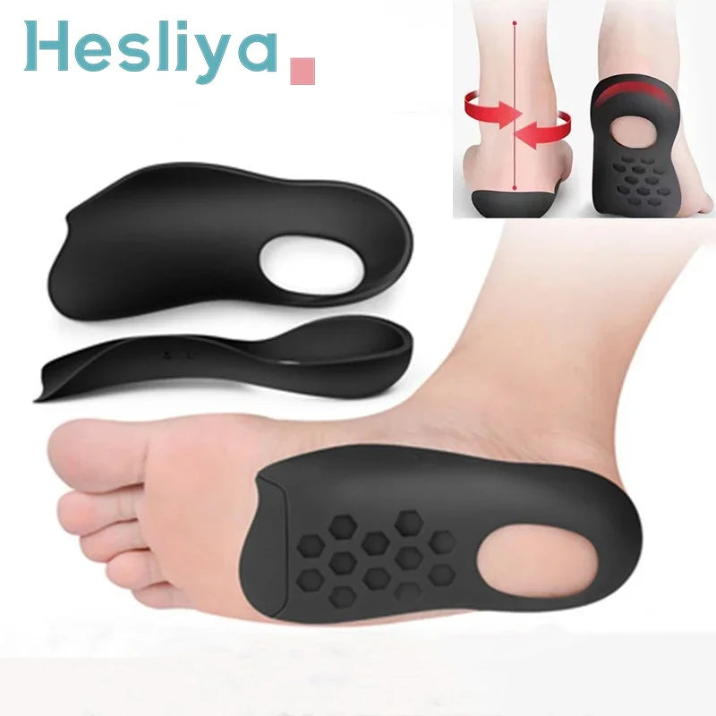 Orthopedic Correction Insoles for Flat Feet and O-Shaped Legs