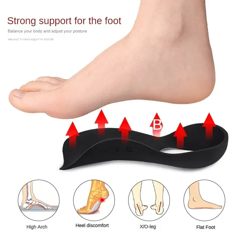 Orthopedic Correction Insoles for Flat Feet and O-Shaped Legs