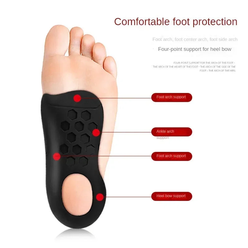 Orthopedic Correction Insoles for Flat Feet and O-Shaped Legs